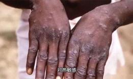 猴子爆料皮肤真假辨别视频